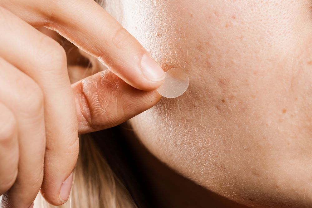 a girl applying pimple patches on face